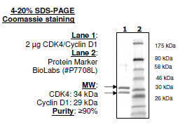 CDK4(EE,T172A)/Cyclin D1, His-tag