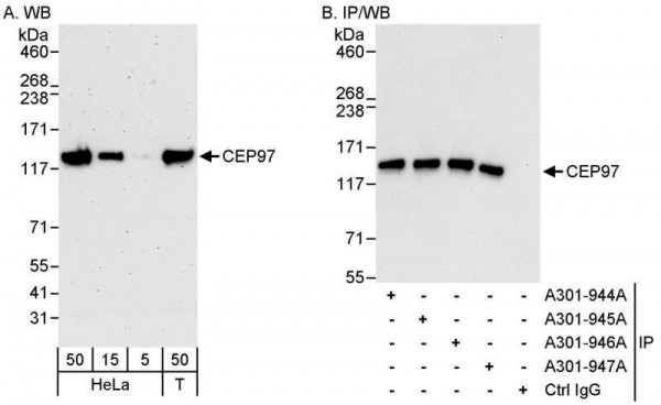 Anti-CEP97