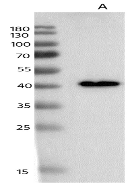 Anti-Adenosine Deaminase Monoclonal Antibody
