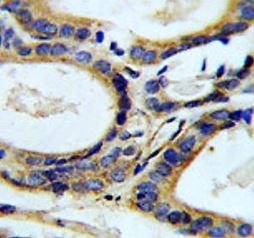 Anti-CCL4 / MIP1 beta