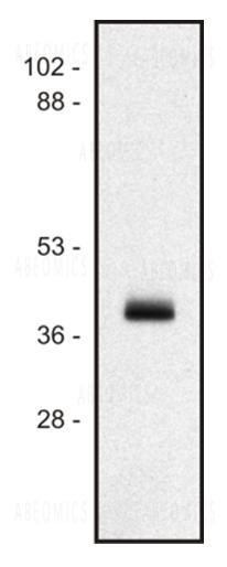 Anti-HLA-Class I Monoclonal Antibody (Clone:MEM-147)