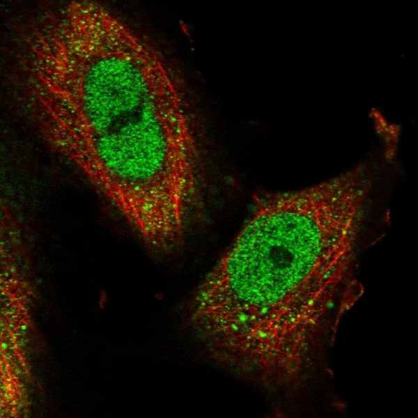Anti-RANBP3