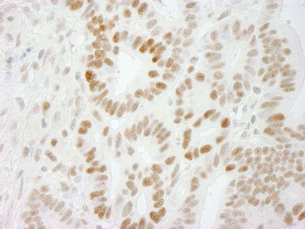 Anti-PPP4R3 Alpha (IHC)