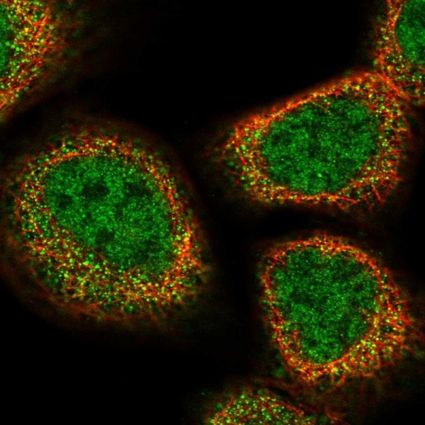 Anti-UFSP2