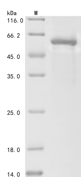 Follicle-stimulating hormone receptor (FSHR), partial, human, recombinant
