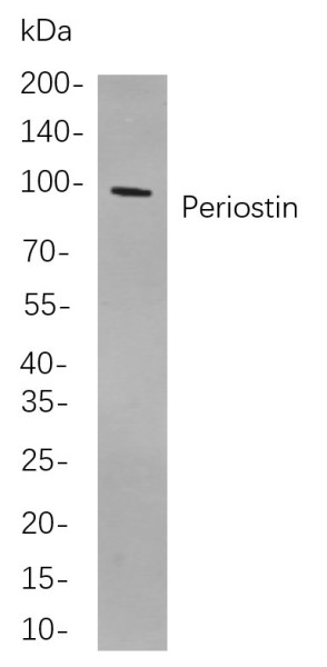 Anti-Recombinant Periostin, clone 9C12