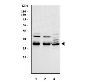 Anti-MEK6 / MKK6
