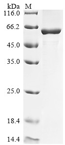 Cathepsin D (CTSD), partial, human, recombinant