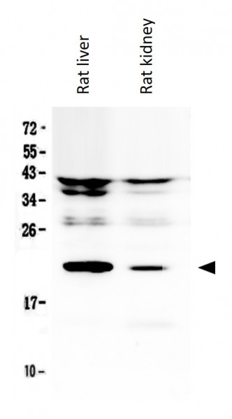 Anti-IL11