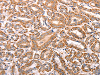 Anti-TRPV4