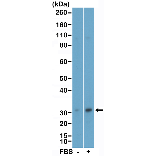 Anti-phospho-eIF4E (Ser209), Rabbit Monoclonal (RM452)