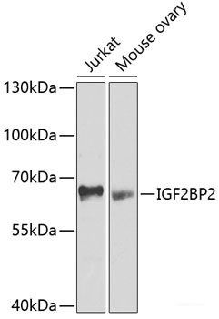 Anti-IGF2BP2