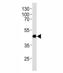 Anti-CXCR7