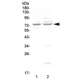 Anti-CHM / Choroideremia protein