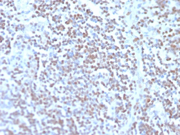 Anti-Cyclin D1 (G1-Cyclin &amp; Mantle Cell Lymphoma Marker), recombinant antibody, clone rCCND1/4752