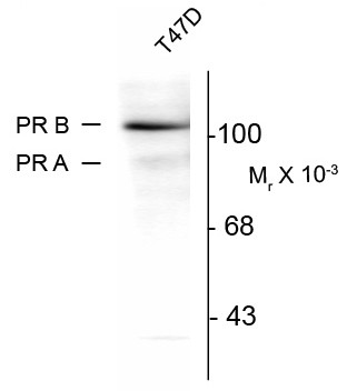 Anti-phospho-Progesterone Receptor (Ser294), clone 608