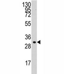 Anti-Cyclin C (CCNC)