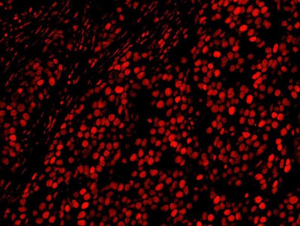 Anti-AKAP8L/HA95 (IHC)