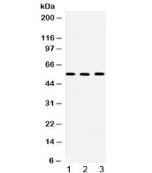 Anti-TCP1 beta / CCT2