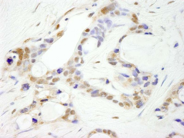 Anti-CPSF100 (IHC)