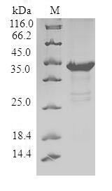 Pleckstrin homology-like domain family A member 2 (PHLDA2), human, recombinant
