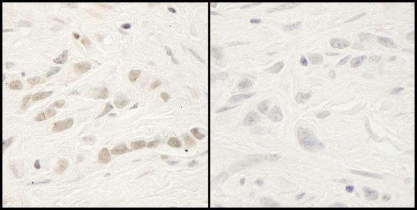 Anti-phospho-RelA (Ser468) (IHC)