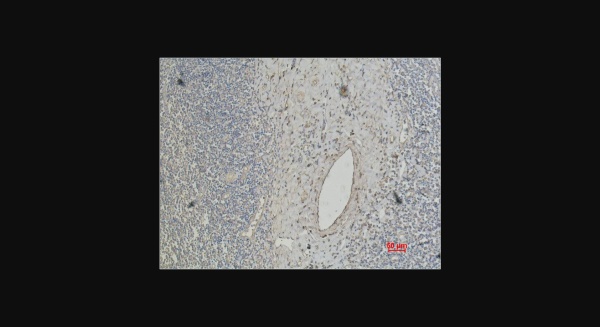 Anti-CD4, monoclonal