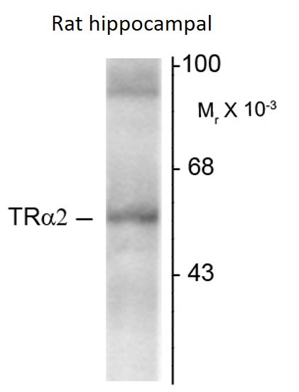 Anti-Thyroid Hormone Receptor alpha, clone 1330