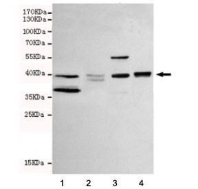 Anti-WNT3A, clone 6H11-H11-G7