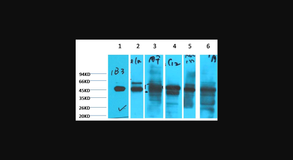 Anti-Cytokeratin 18, monoclonal