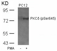 Anti-phospho-PKC delta (Ser645)