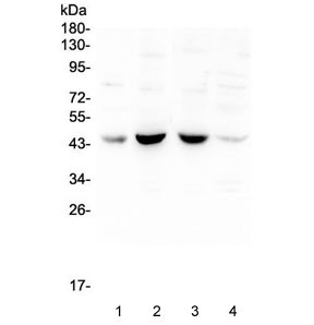 Anti-BRN3A