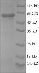 Protein disulfide-isomerase (P4HB), partial, recombinant human