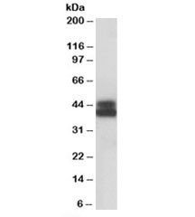 Anti-HLA-B