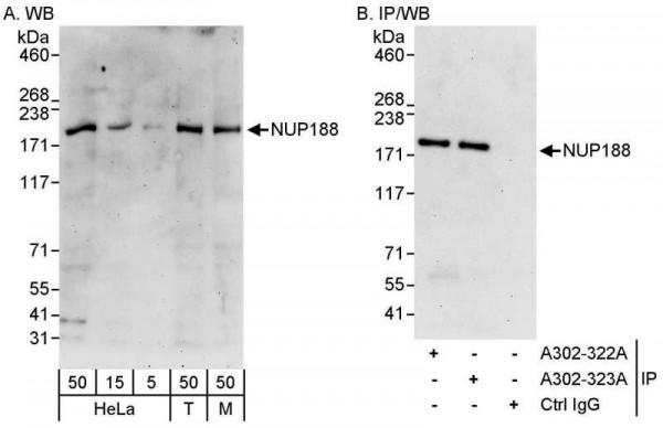 Anti-NUP188