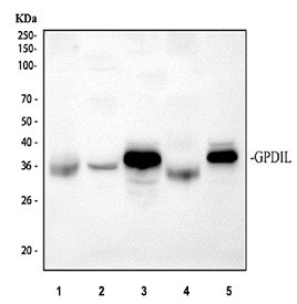 Anti-GPD1L / Glycerol-3-phosphate dehydrogenase 1-like protein