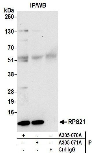 Anti-RPS21/Ribosomal Protein S21