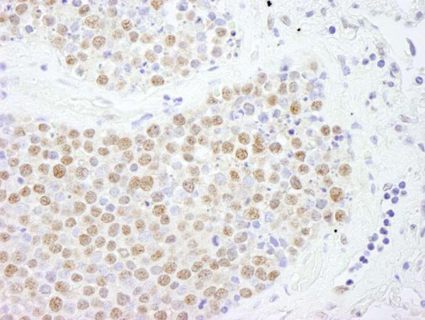 Anti-FOXK2 (IHC)