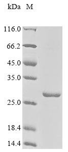 Myocardin-related transcription factor A (MRTFA), partial, human, recombinant