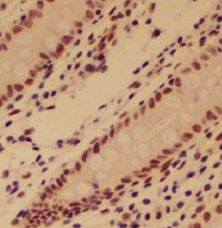 Anti-HIF-1 beta