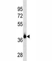 Anti-EpCAM, clone 463CT25.1.1