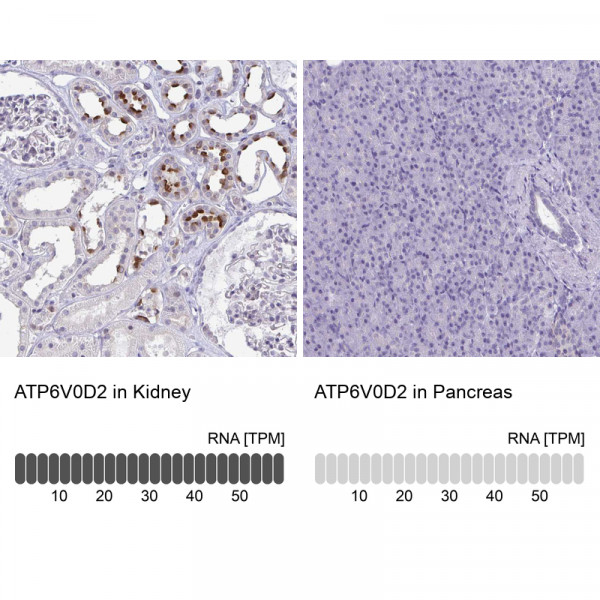 Anti-ATP6V0D2