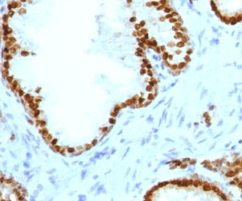 Anti-ATRX / RAD54, clone ATMRX-1R