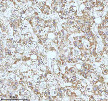 Anti-GAREM1 / GRB2-associated and regulator of MAPK protein 1