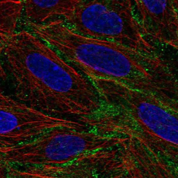 Anti-BASP1