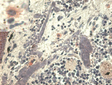 Anti-HLA-G, clone MEM-G/1