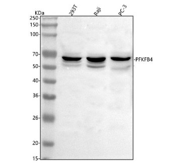 Anti-PFKFB4 / PFK/FBPase 4