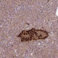 Anti-DYNC1LI2