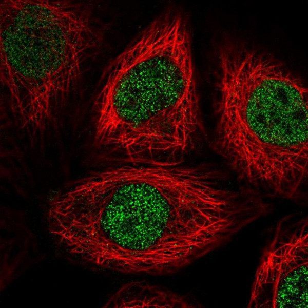 Anti-PSMA1