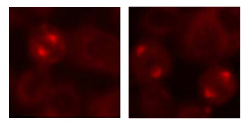 Anti-Aurora Kinase A, clone 2E3-C10-C11-G6